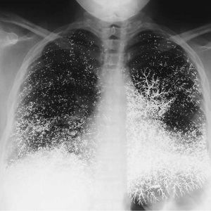 Meet your Posher, ‎